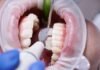 4 Modern Treatments Offered By A Periodontist In Kansas City 4 Modern Treatments Offered By A Periodontist In Kansas City