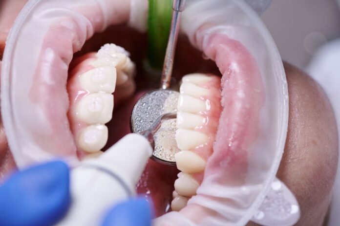 4 Modern Treatments Offered By A Periodontist In Kansas City