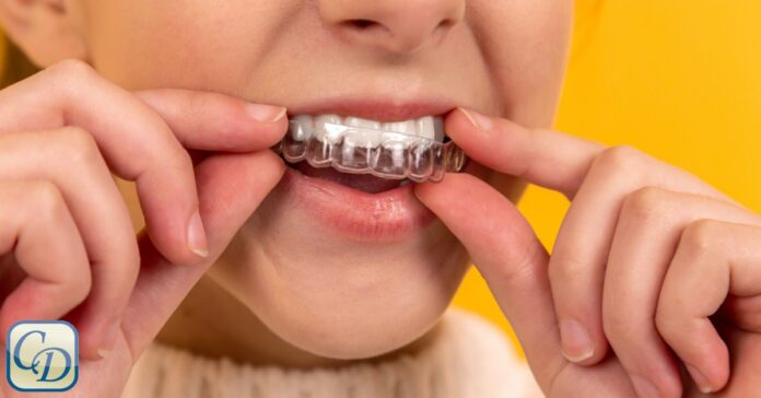 How Insurance Coverage Works with Invisalign in Kelowna